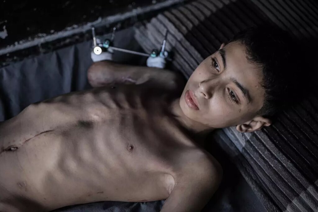 semirin umudu yeniden hayata donmek DBEHFFJv